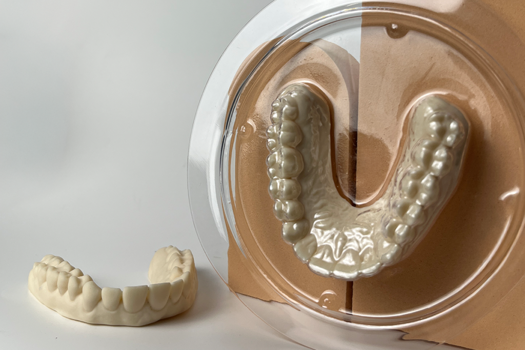 Alinhador invisível e modelo dentário impressos em 3D, utilizados em tratamentos ortodônticos personalizados