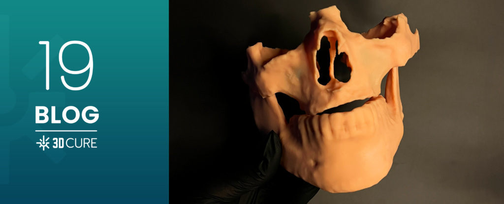 Impressão 3D na odontologia: biomodelo anatômico usado em aplicações clínicas como próteses, implantes e cirurgias.